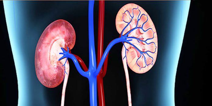 kidney transplant process